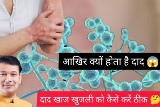 Fungal Infection दाद से कैसे मिलेगा निजाद | Dr. Mahendra | Health Mantra | Episode 1 18 wG77rV88eHY HD