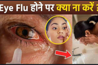 उत्तराखंड में कंजेक्टिवाइटिस यानि आई फ्लू को लेकर जारी हुई गाइडलाइन 10 Screenshot 20230803 224849