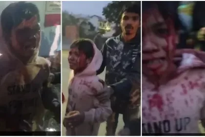 देहरादून के केनाल रोड पर बाघ ने किया बच्चे पर हमला | बच्चा हुआ घायल | राहगीरों ने बाघ को भगाया 12 IMG 20240114 204434 500 x 281 pixel.jpg