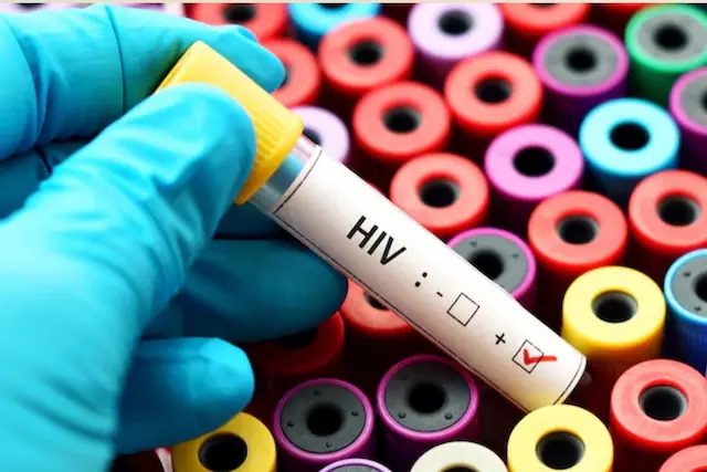 Big Breaking News: देहरादून में अचानक बढ़े AIDS के मरीज,1622 लोग HIV संक्रमित-Newsnetra 3 Putin Nuclear 5 2025 05 fe088ef0e47b54ebef09a617bb95e6ba 3x2 1