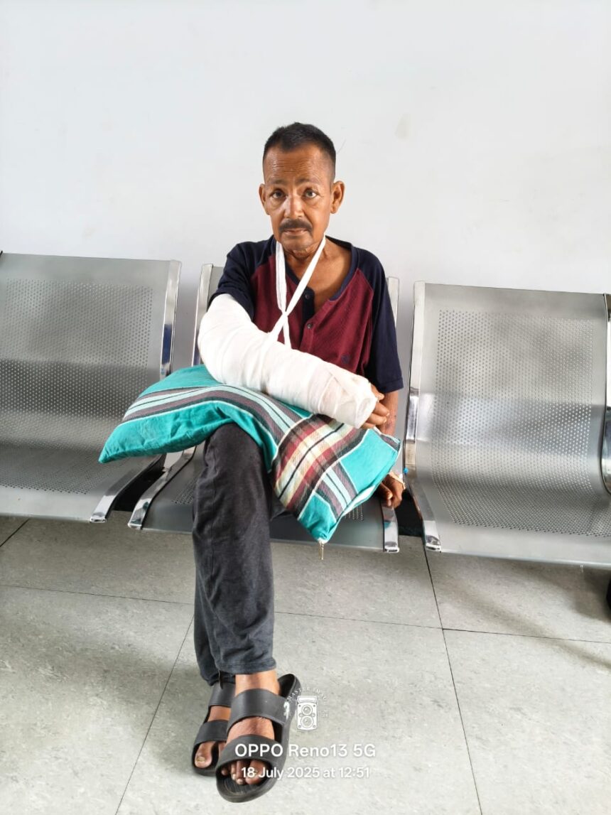 दून अस्पताल से लाइलाज रेफर हुए व्यथित राजू का, बर्न स्पेशलिस्ट हेल्पिंग हैंड्स यहां ऑपरेशन हुआ संपन्न;-Newsnetra 3 IMG 20250720 WA0014