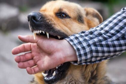 dog bite